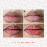 SOS LipSoftie® Lip Treatment