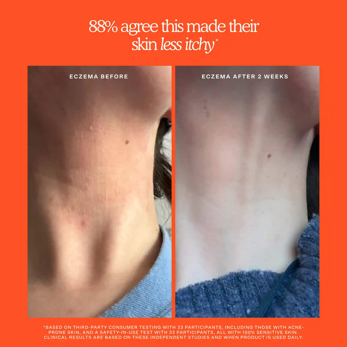 SOS Rescue + Relief Body Wash Treatment