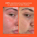 SOS 3-Step Skincare Set
